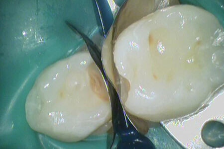 Примеры работ QR Dental