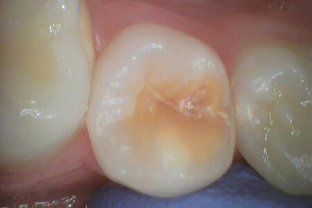 Примеры работ QR Dental