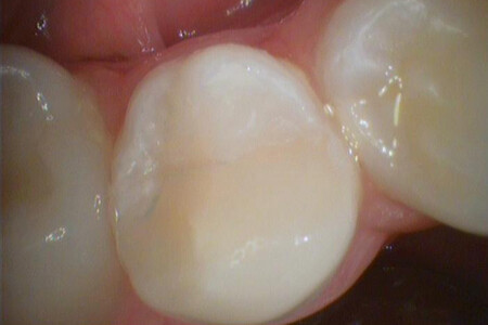 Примеры работ QR Dental