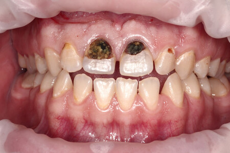 Примеры работ QR Dental