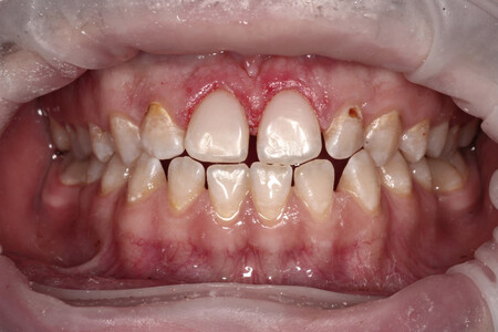 Примеры работ QR Dental