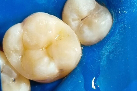 Примеры работ QR Dental