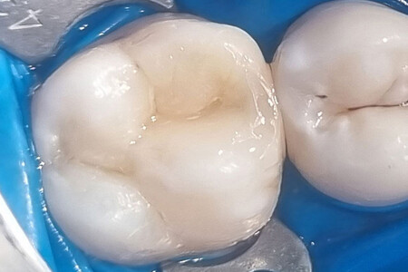 Примеры работ QR Dental