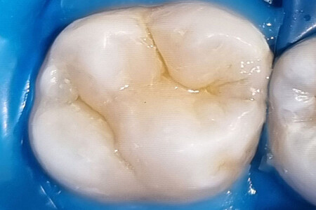 Примеры работ QR Dental