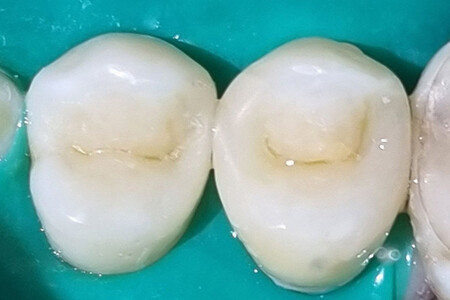 Примеры работ QR Dental