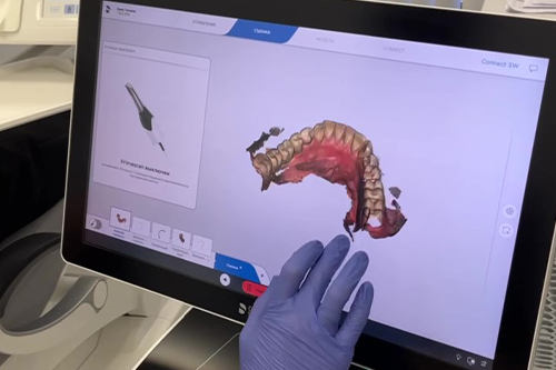 Кому противопоказана имплантация зубов